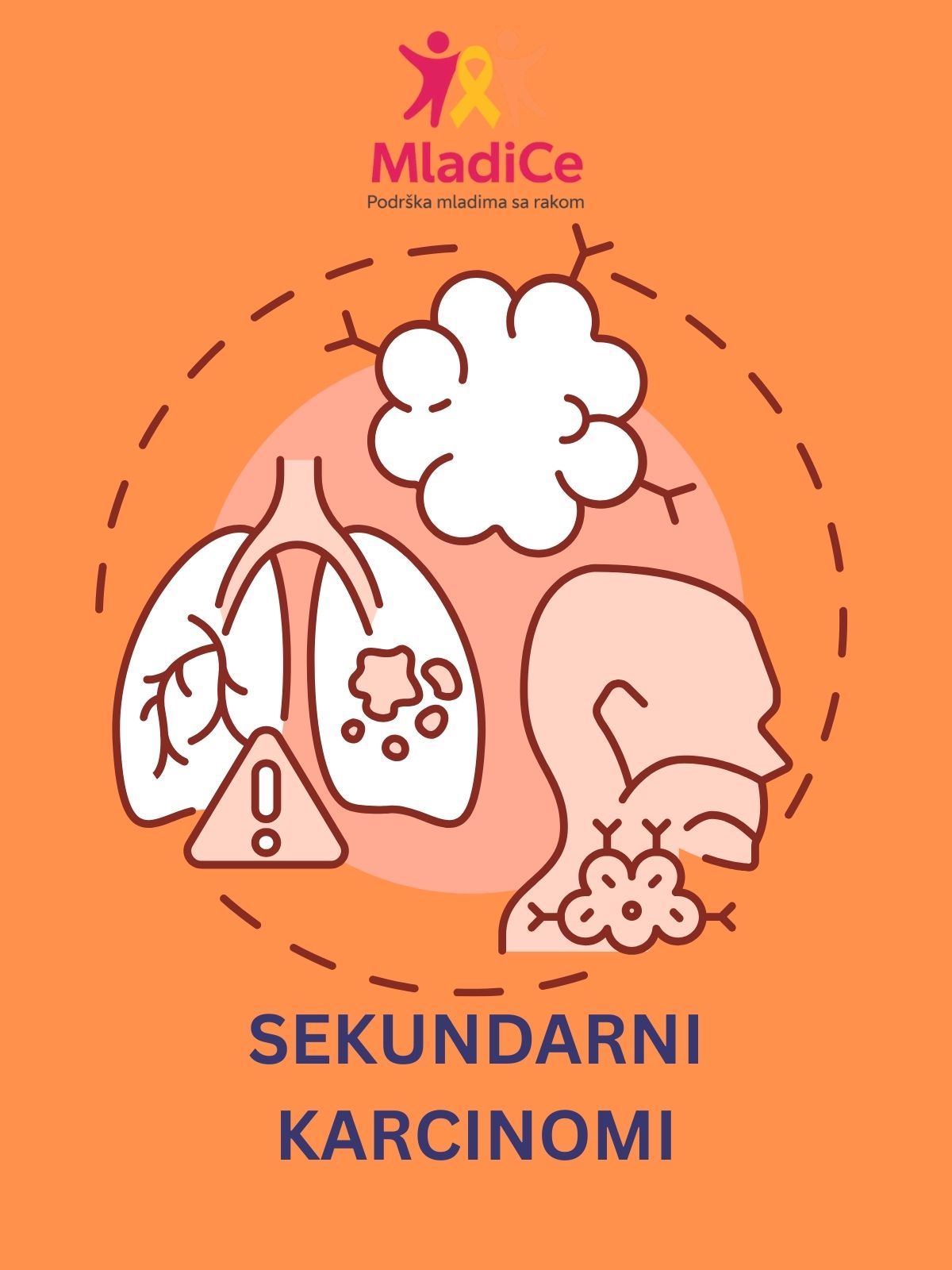 Naslovna: Sekundarni karcinomi